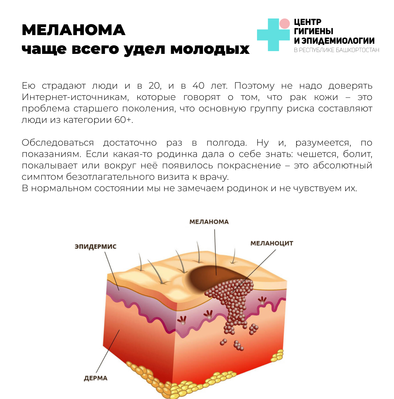 Факторы риска меланомы. Эпидемиология заболевания меланомы. Новообразования кожные на латыни.